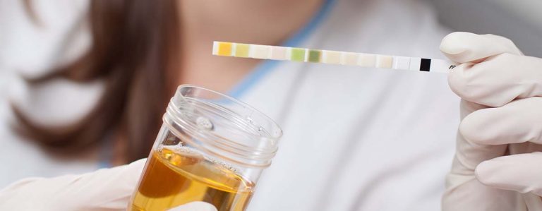 Pflegerin führt Urintest mittels Teststreifen durch
