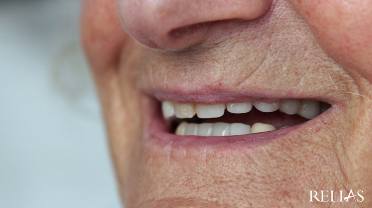 Auf diesem Bild sehen Sie einen geöffneten Mund mit Zähnen einer älteren Person.