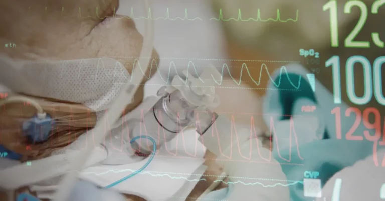 Nahaufnahme einer beatmeten Person mit eingeblendeten Vitalzeichen auf Monitor.