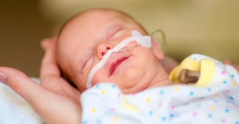 Frühgeborenes mit Nasensonde liegt behütet in einer Hand und schläft.