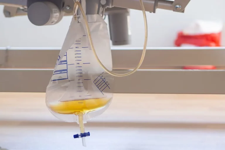 Gefüllter Urinbeutel hängt an einem Pflegebett.