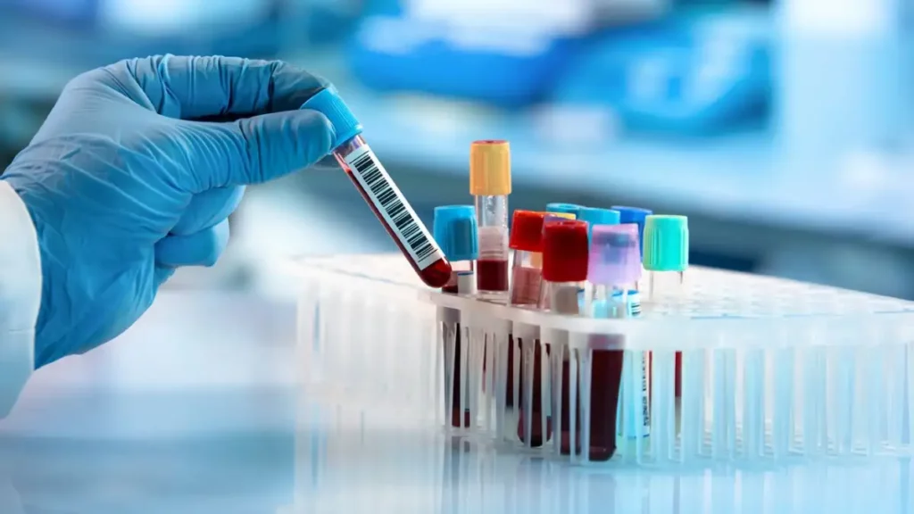 gefüllte Blutröhrchen zur Diagnostik von Sepsis