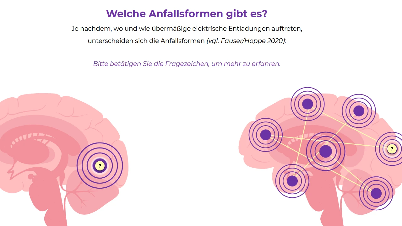 gehirn-anfallsherd-einzelbereich