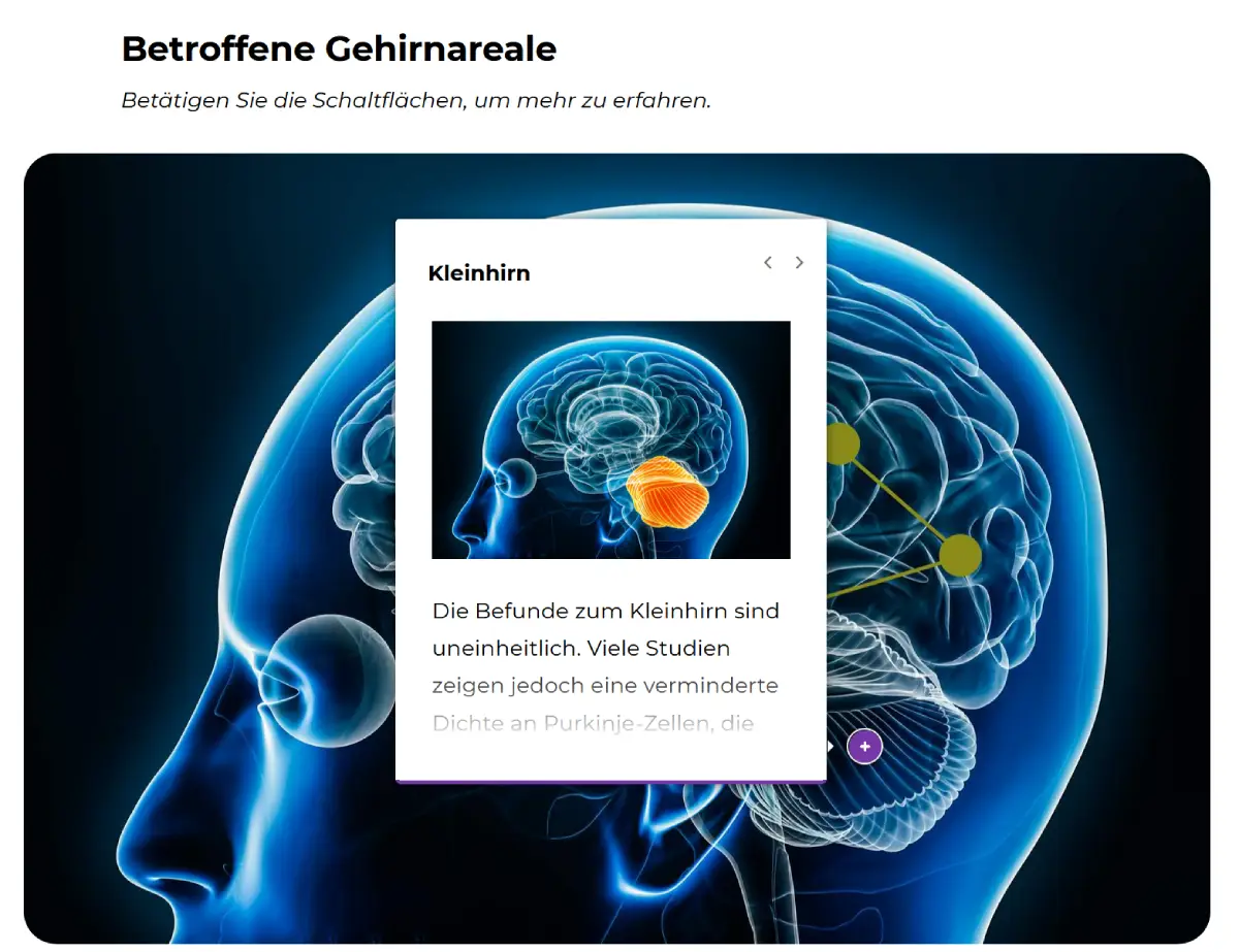 interaktive-gehirngrafik