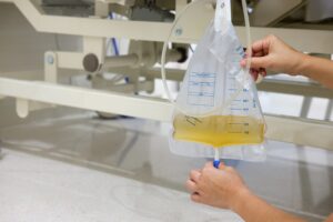 Hände öffnen Ablassventil eines Urinbeutels mit gelblicher Flüssigkeit.
