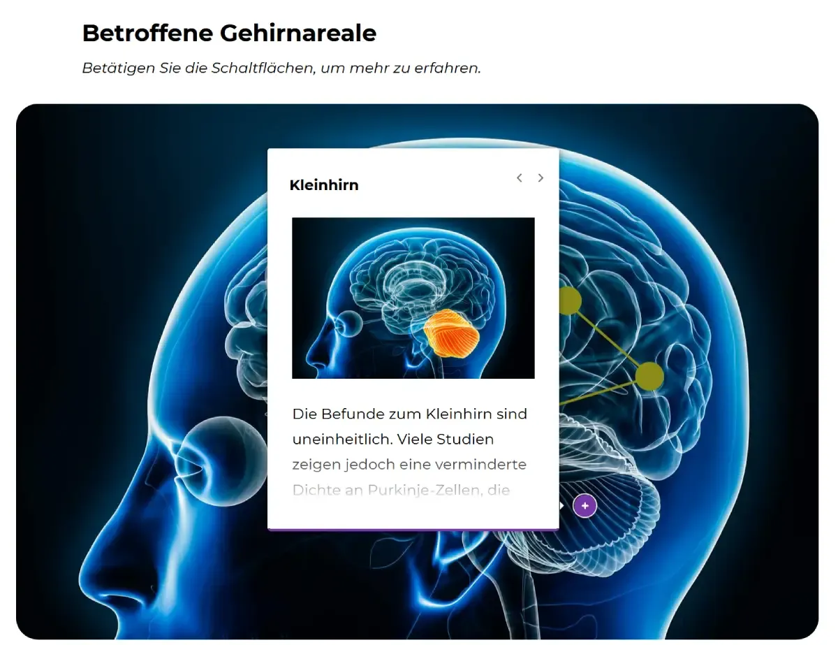 interaktive-gehirngrafik