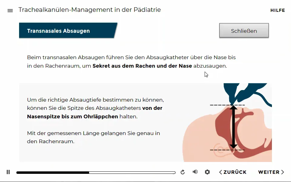 E-Learning-Kursreihe Pädiatrie: Visualisierung Trachealkanülen-Management