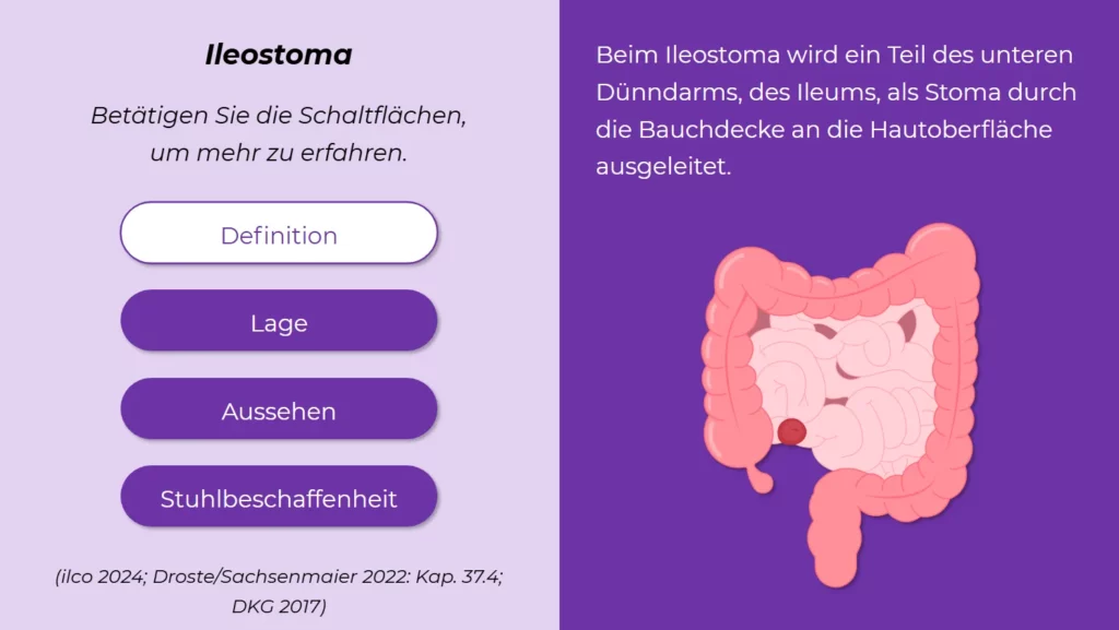 Ausschnitt interaktive Szene aus dem E-Learning-Kurs zur Enterostoma Versorgung in der Pflege