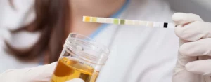Pflegerin führt Urintest mittels Teststreifen durch